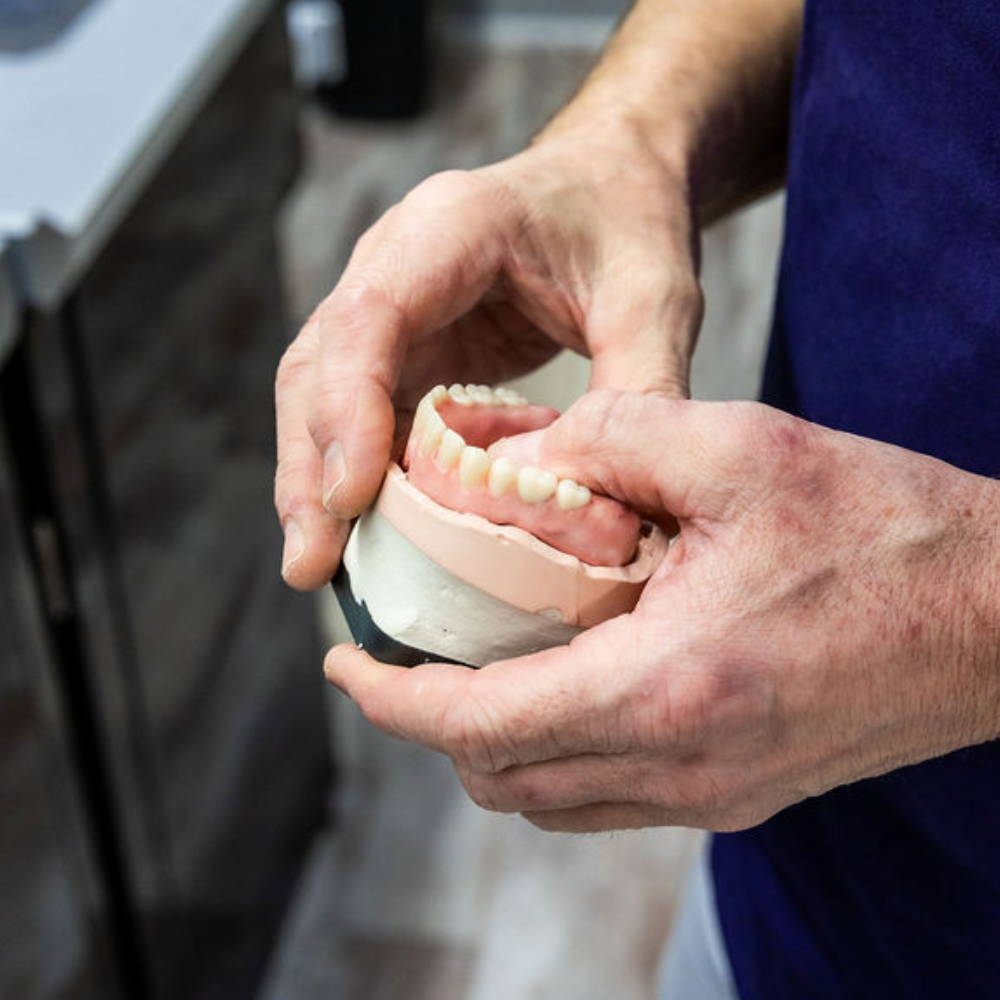 Kunstgebit op implantaten - Klikgebit