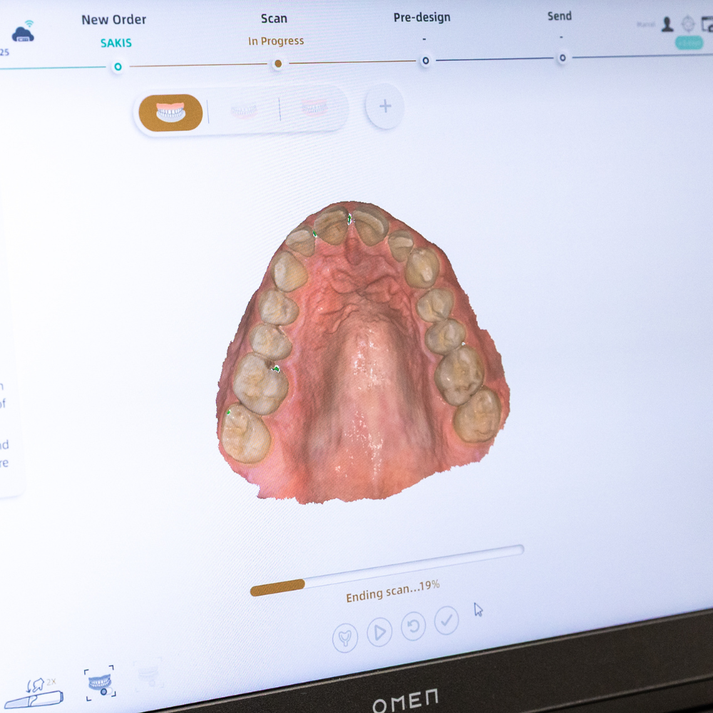 Eerste kunstgebit 's-Gravenzande