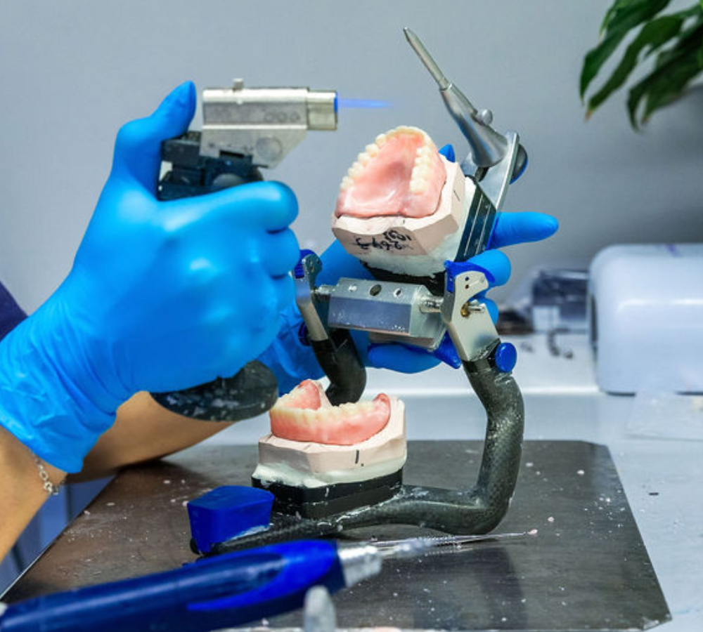 Kunstgebit reparatie of opvullen 's-Gravenzande